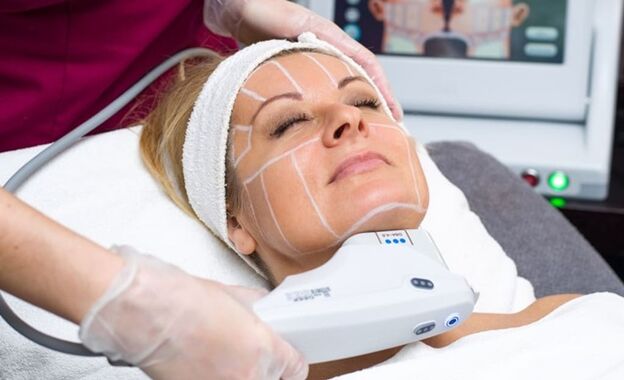 Elevación ultrasónica SMAS para estiramiento facial no quirúrgico