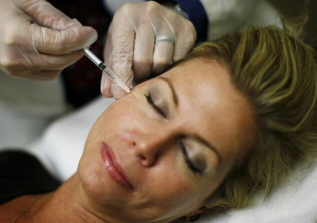 Introducción de rellenos en la piel de la cara un método para apretar las inyecciones. 