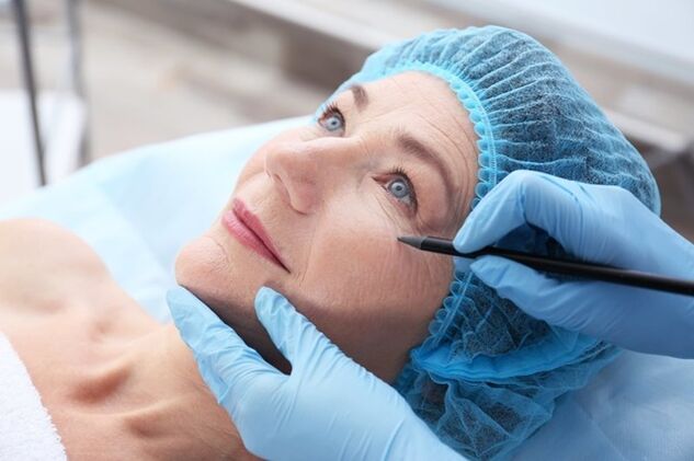 Prepárese para un procedimiento de estiramiento facial sin cirugía