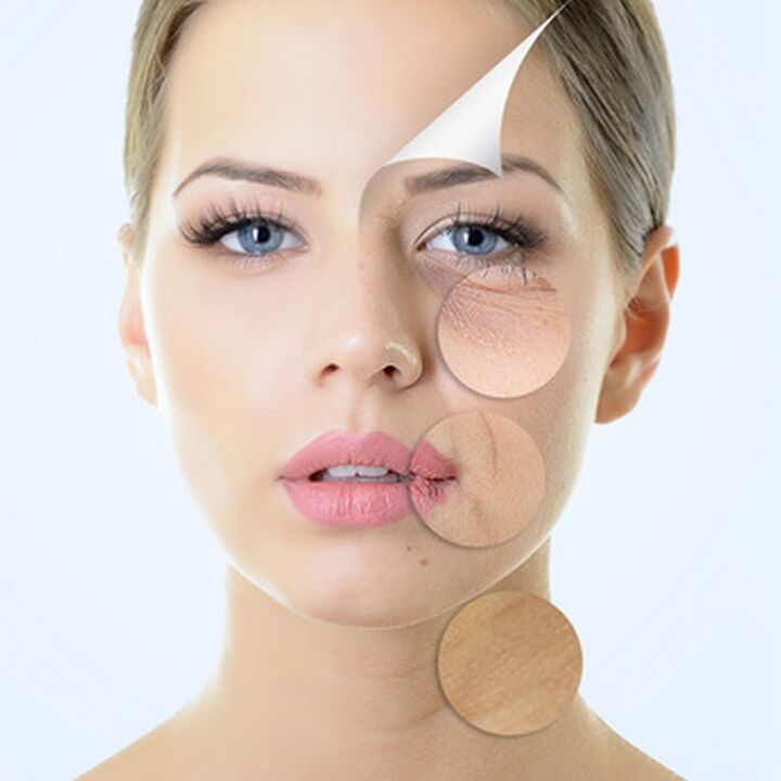 Imperfecciones de la piel del rostro una indicación para procedimientos anti-envejecimiento. 